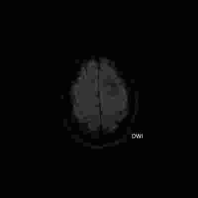 205-2-5