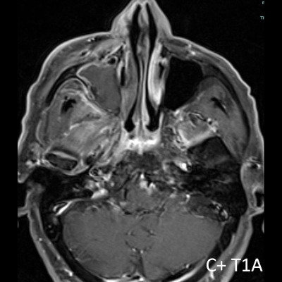 217-2-3