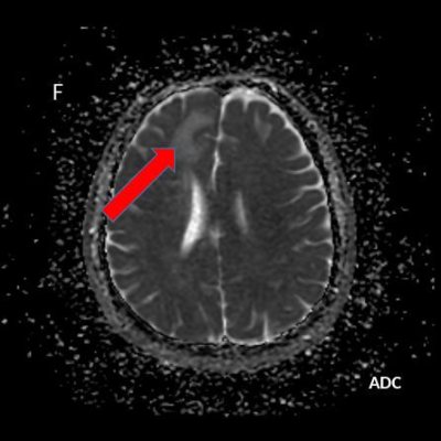 263-2-6
