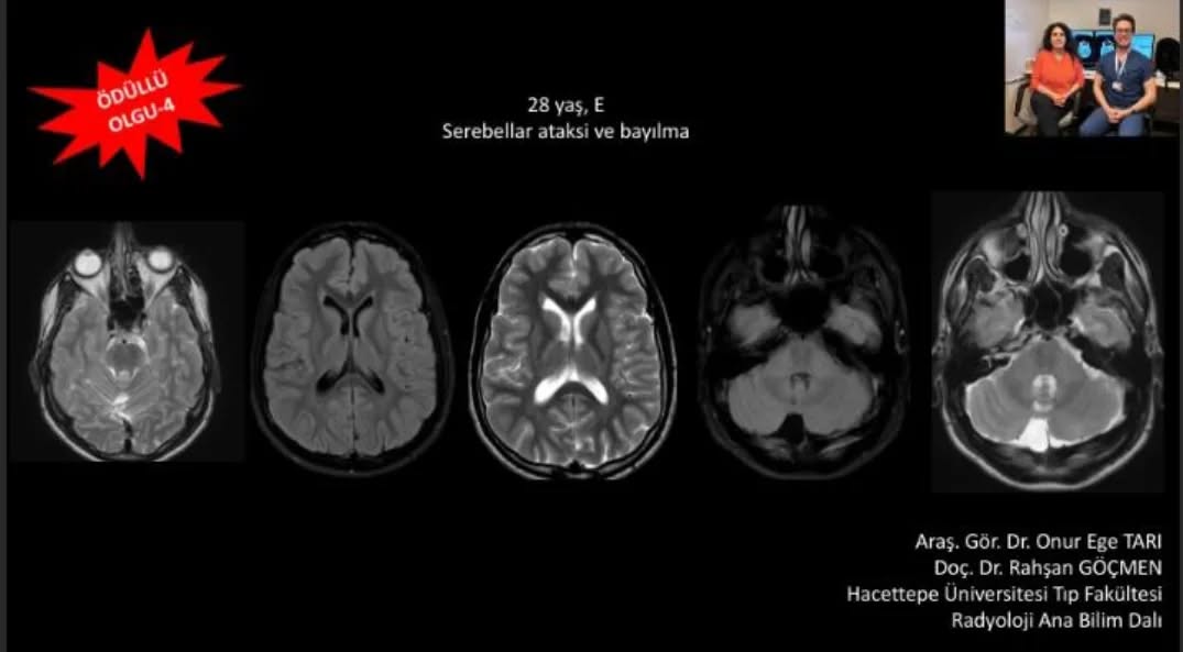 📣📣📣Haftanın ödüllü olgu sorusu yayınlandı. 
Yanıtlarınızı www.tnrd.org.tr adresinden bekliyoruz.