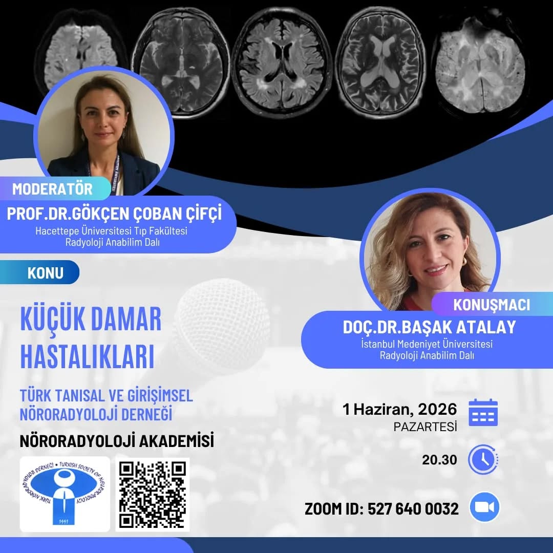 Nöroradyoloji Akademisi
01 Haziran 2026 tarihinde saat: 20:30 'da
https://us02web.zoom.us/j/5276400032 link üzerinden giriş yapabilirsiniz.