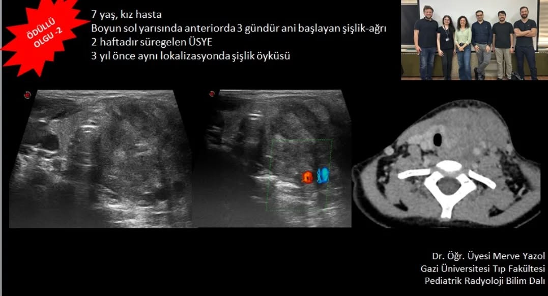 📣📣📣Haftanın ödüllü olgu sorusu yayınlandı. 
Yanıtlarınızı www.tnrd.org.tr adresinden bekliyoruz.