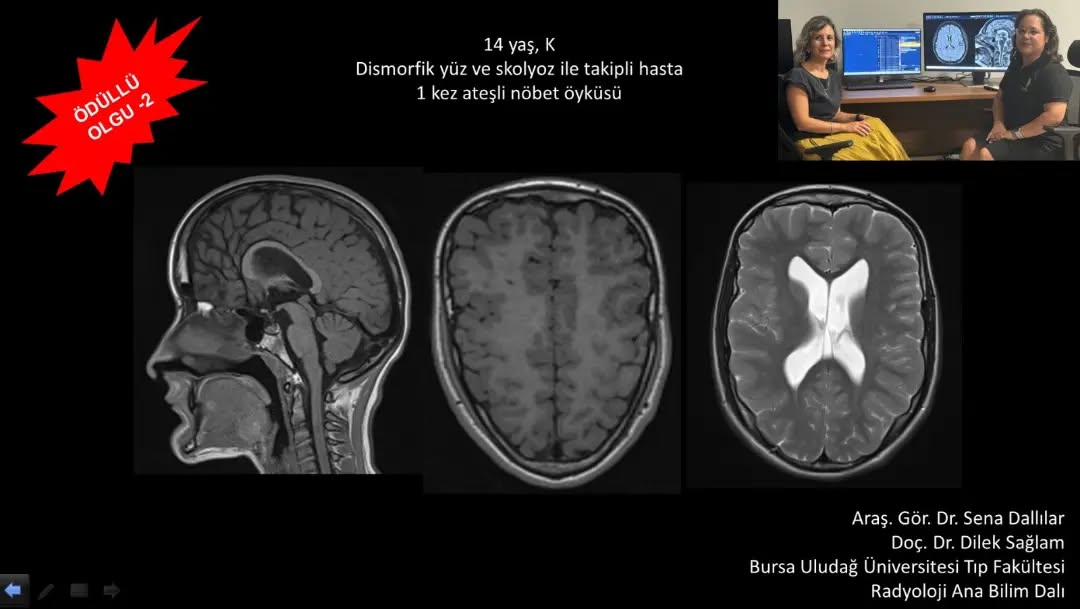 📣📣📣Haftanın ödüllü olgu sorusu yayınlandı.
Yanıtlarınızı www.tnrd.org.tr adresinden bekliyoruz.